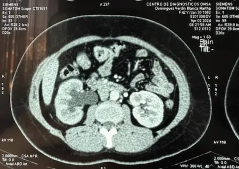 CT Scan, Abdominal Imaging, Medical Imaging